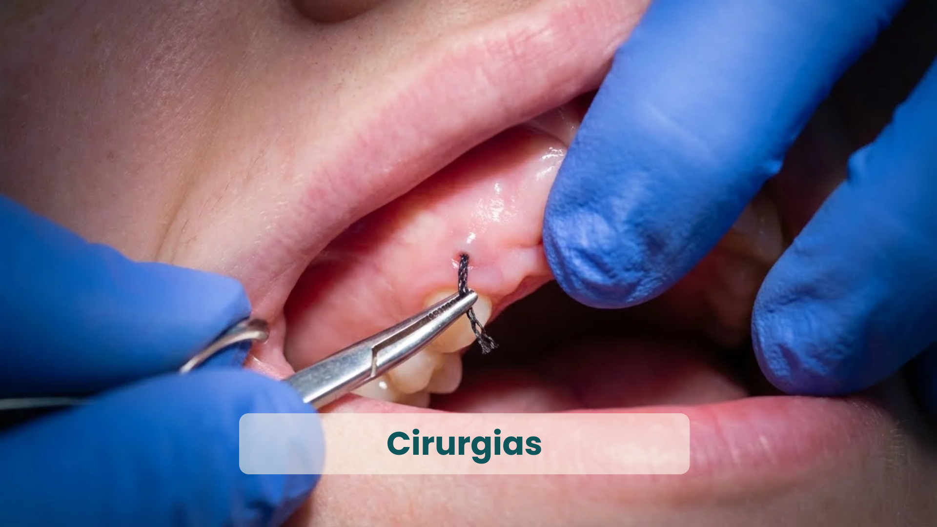 Clínica Odontológica em Natal, com as principais Especialidades_ Cirurgias