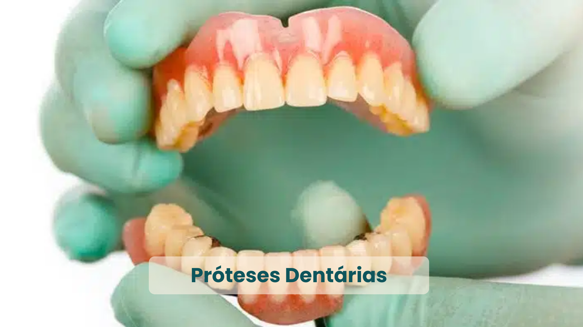 Clínica Odontológica em Natal, com as principais Especialidades_ Próteses
