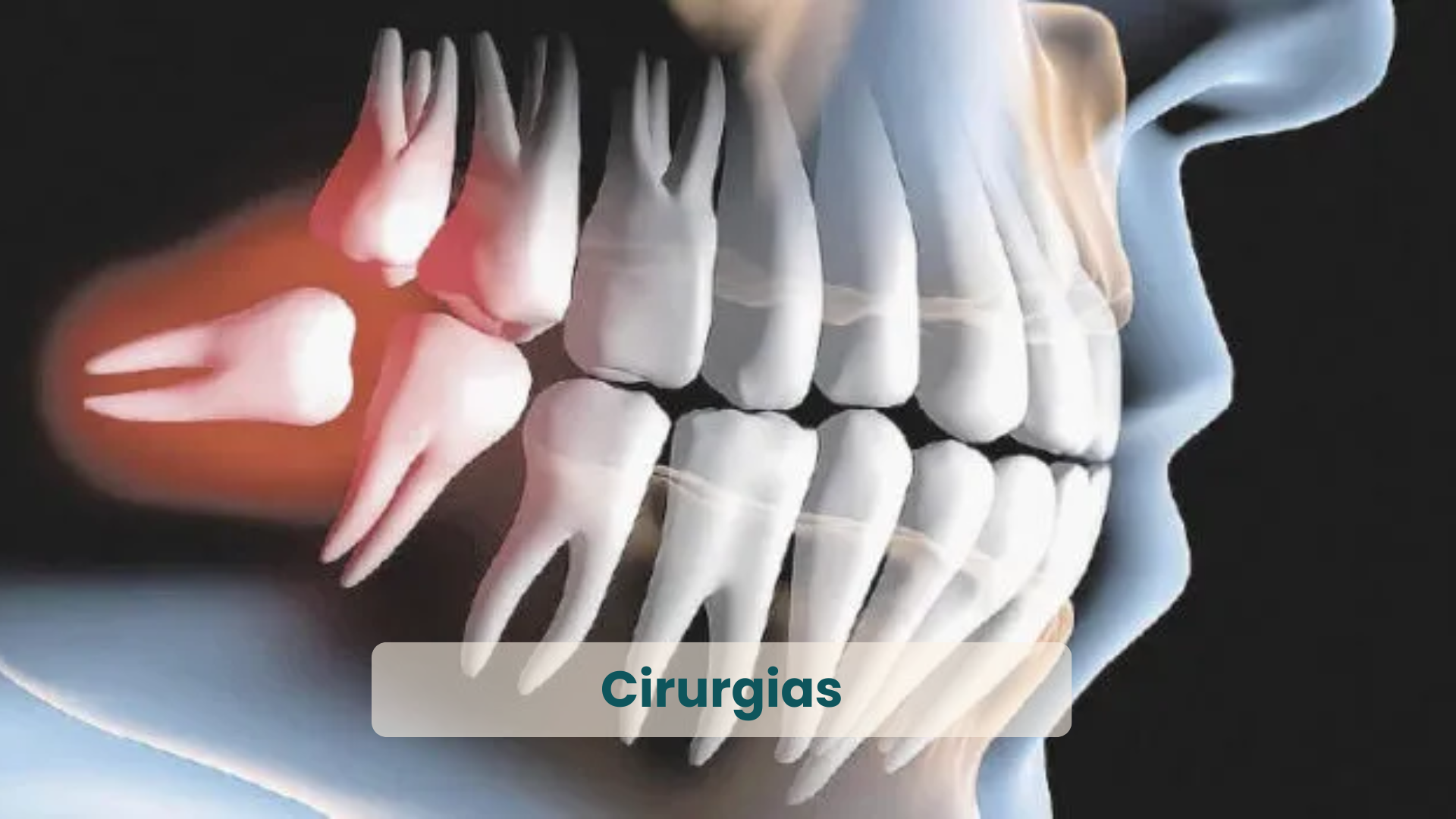 Especialidades e serviços odontológicos da Clínica Dualle_ Cirurgias