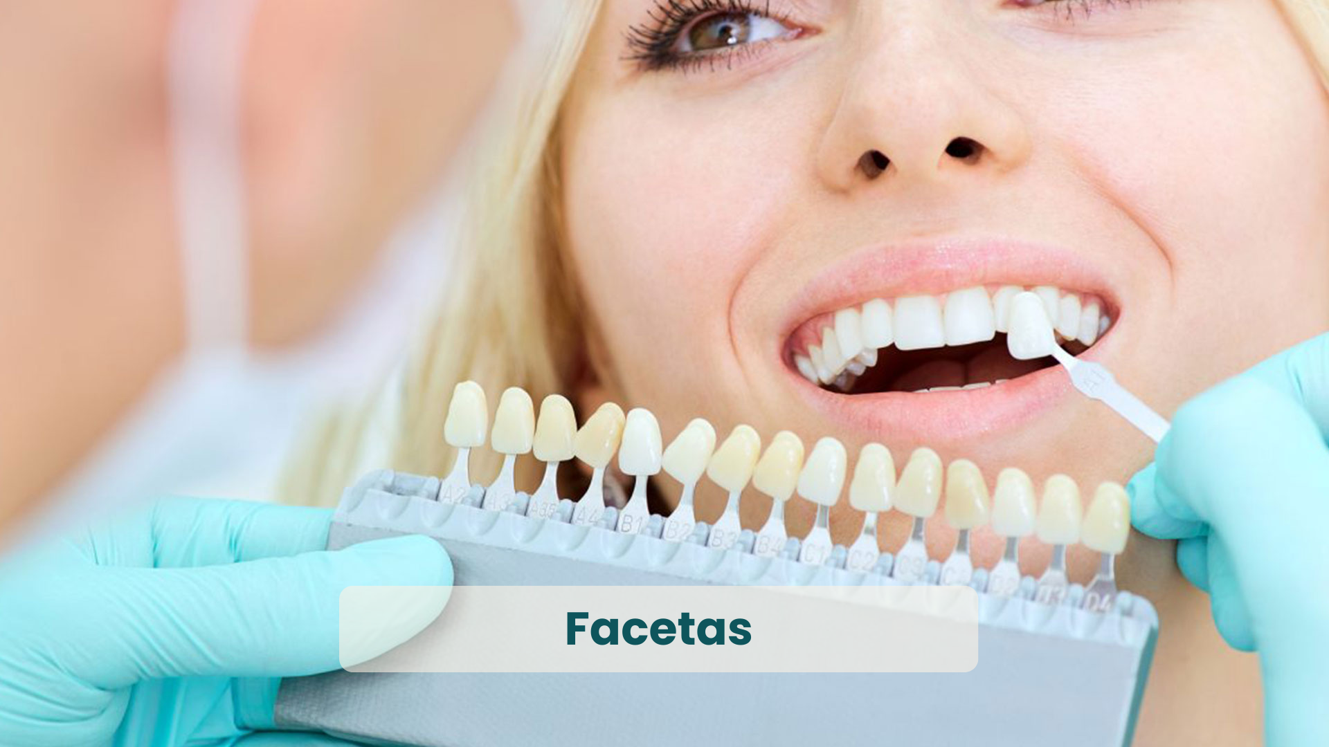 Especialidades e serviços odontológicos da Clínica Dualle_ Facetas