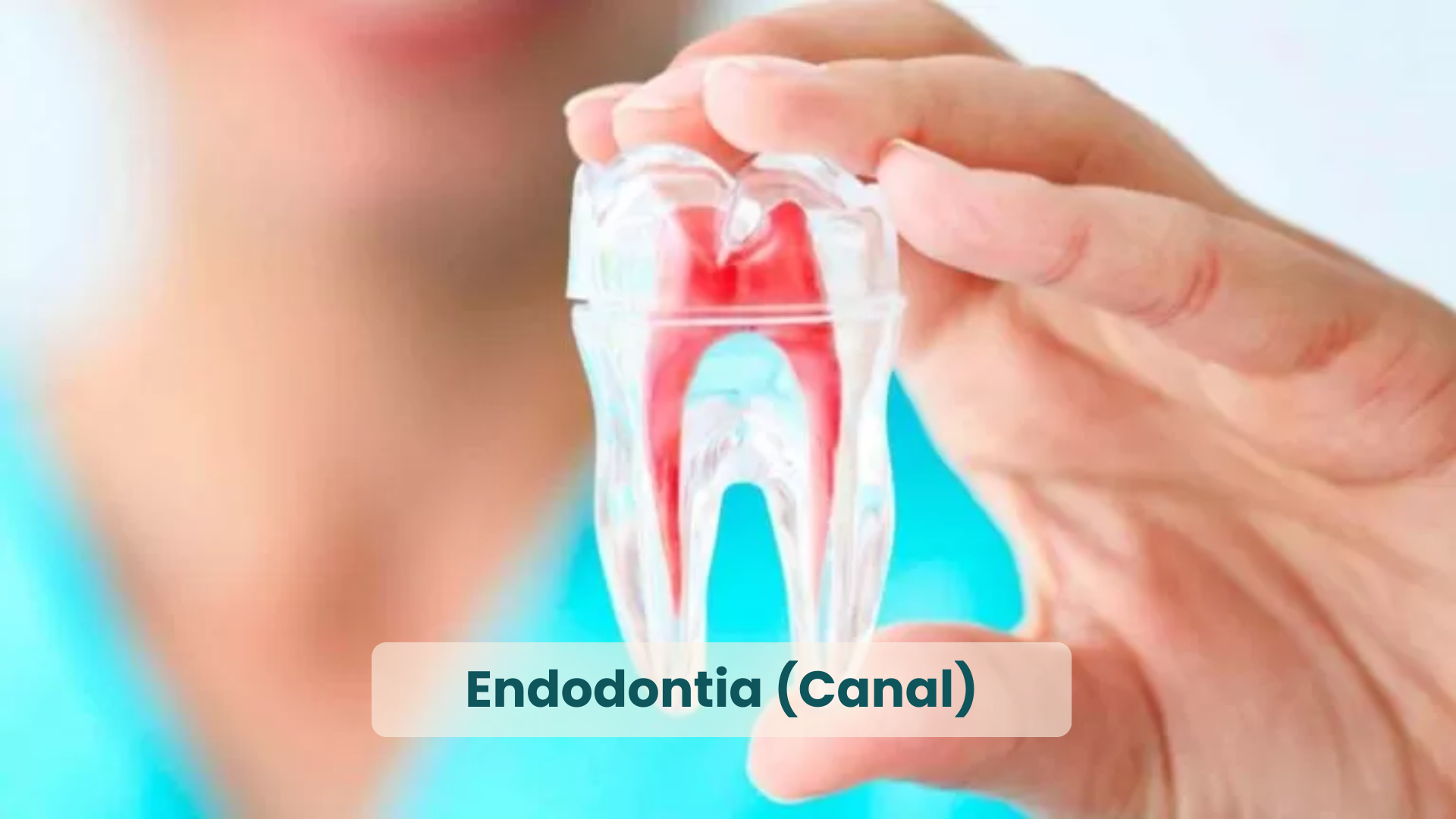 Melhores Dentistas de Natal RN, em Endodontia (Canal)