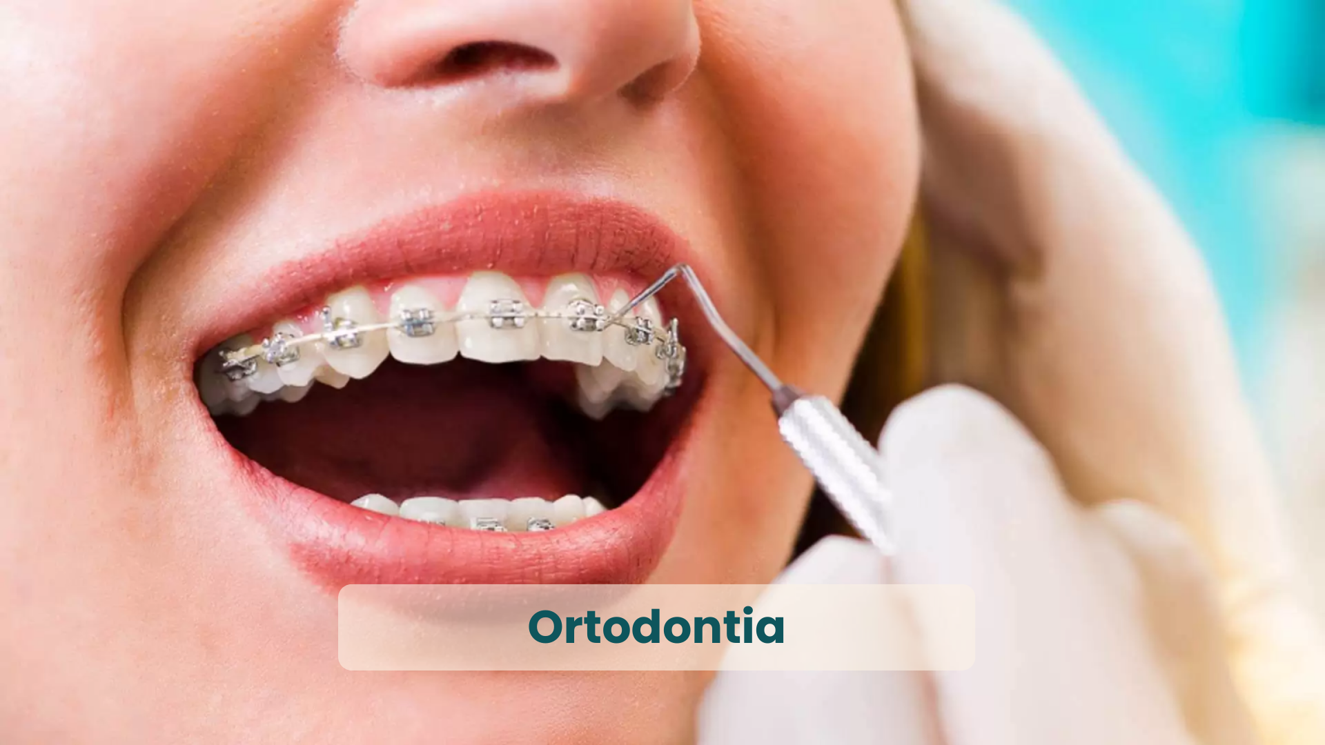 Melhores Dentistas de Natal RN, em Ortodontia